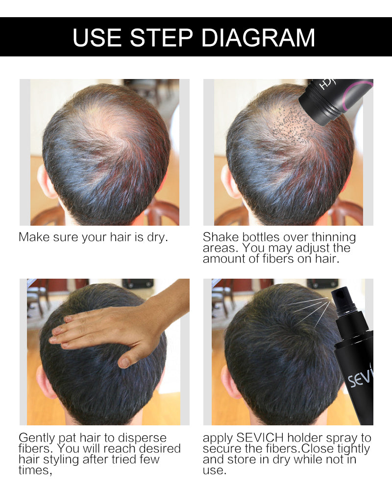 Hair Building Anti Hair Loss - MIM'S Kollectionz